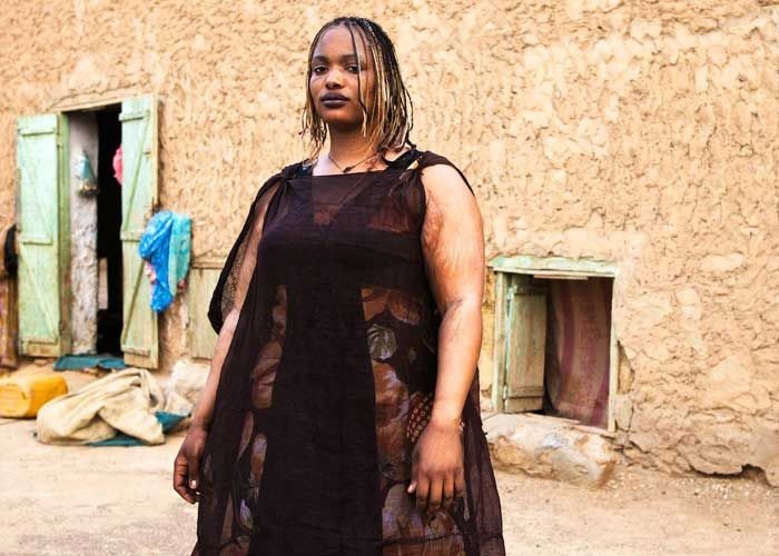 Mauritânia curiosidades: obesidade.