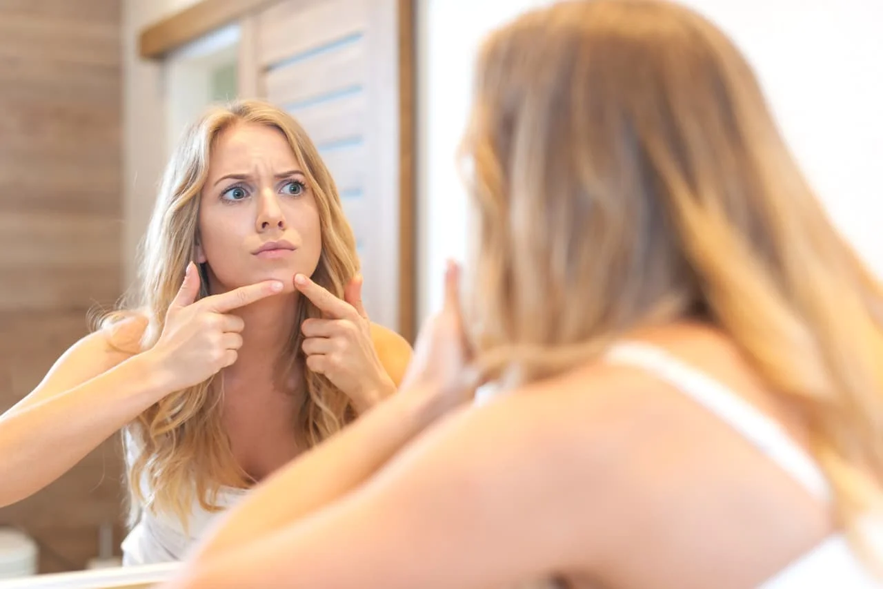 Alimentos que ajudam na acne.