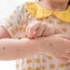 menina e mosquitos