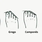 Veja como a forma dos seus pés pode revelar a sua personalidade