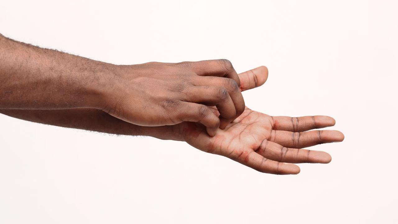 O que significa coçar as mãos?