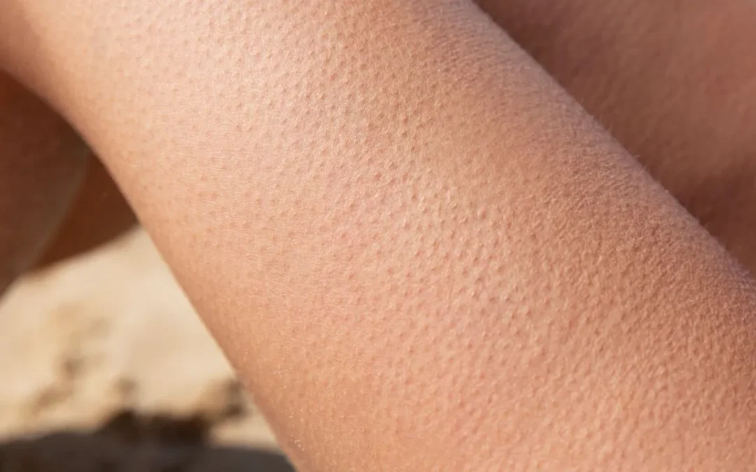 Não é só frio! Veja o real significado oculto do arrepio