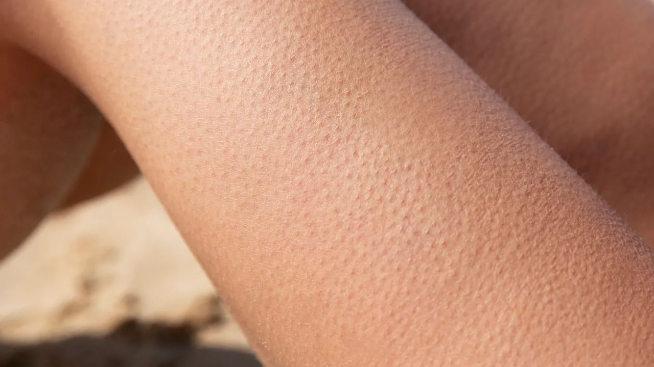 featured_img É isso o que realmente acontece quando o seu corpo arrepia